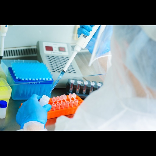[0597-Oneq-V229-100R] Epizootic hemorrhagic disease virus detection kits, onesize:step PCR, 100 rxn